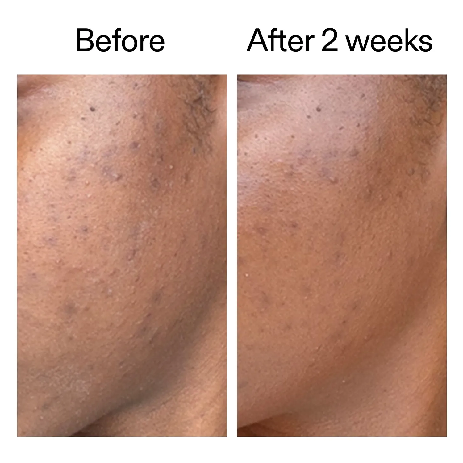 THE INKEY LIST 360 Skin Clearing sérum 30ml imperfections
