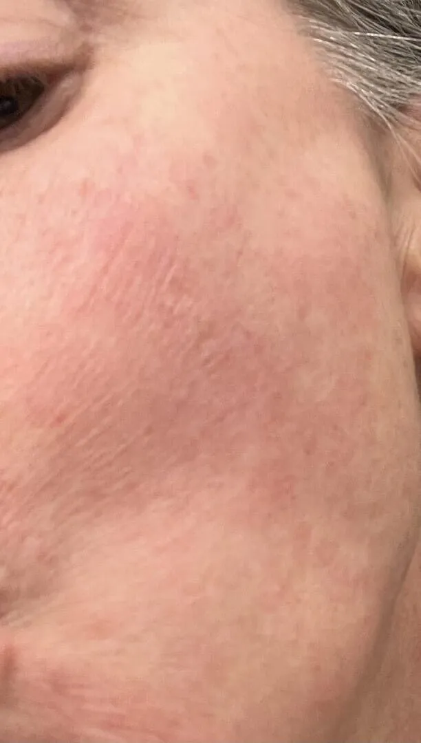 VT Cosmetics TX-Toning Daily Mask masque taches