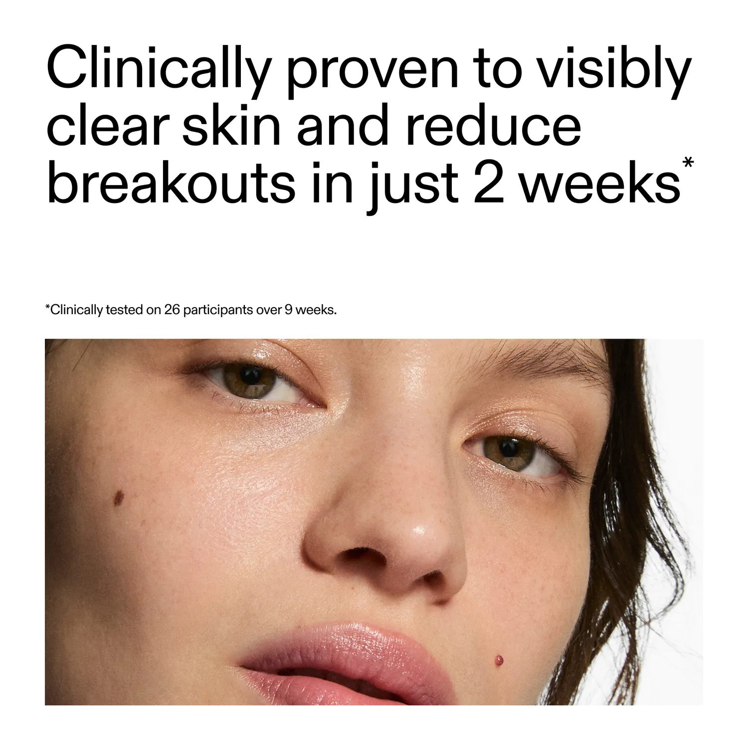 THE INKEY LIST 360 Skin Clearing sérum 30ml imperfections