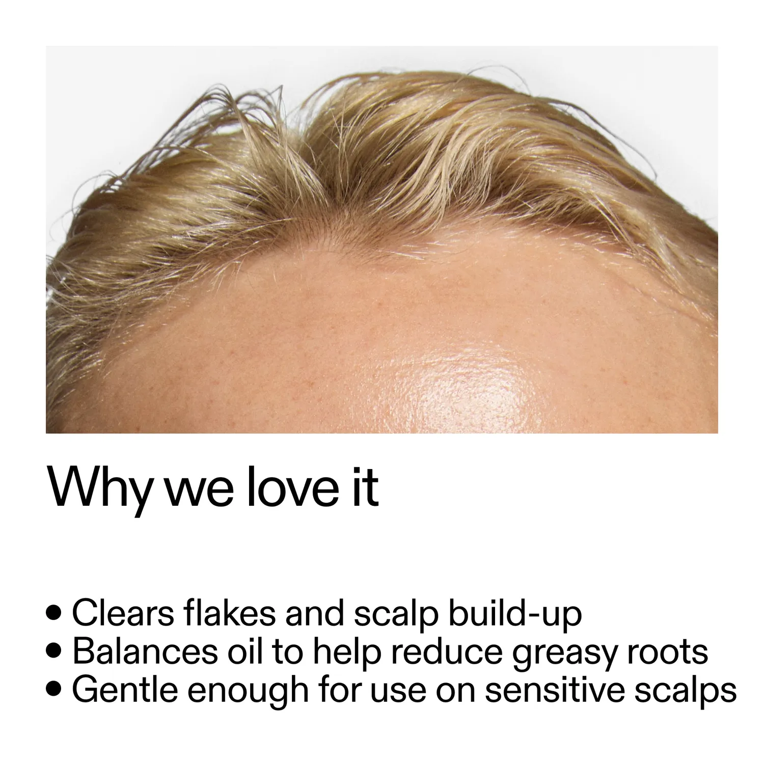 THE INKEY LIST Salicylic Acid soin cuir chevelu exfoliant acide