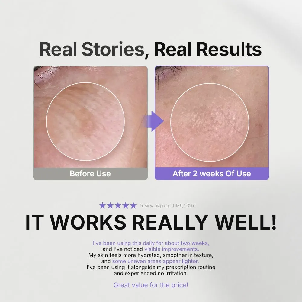 Genabelle Melacare crème intensive 50ml taches
