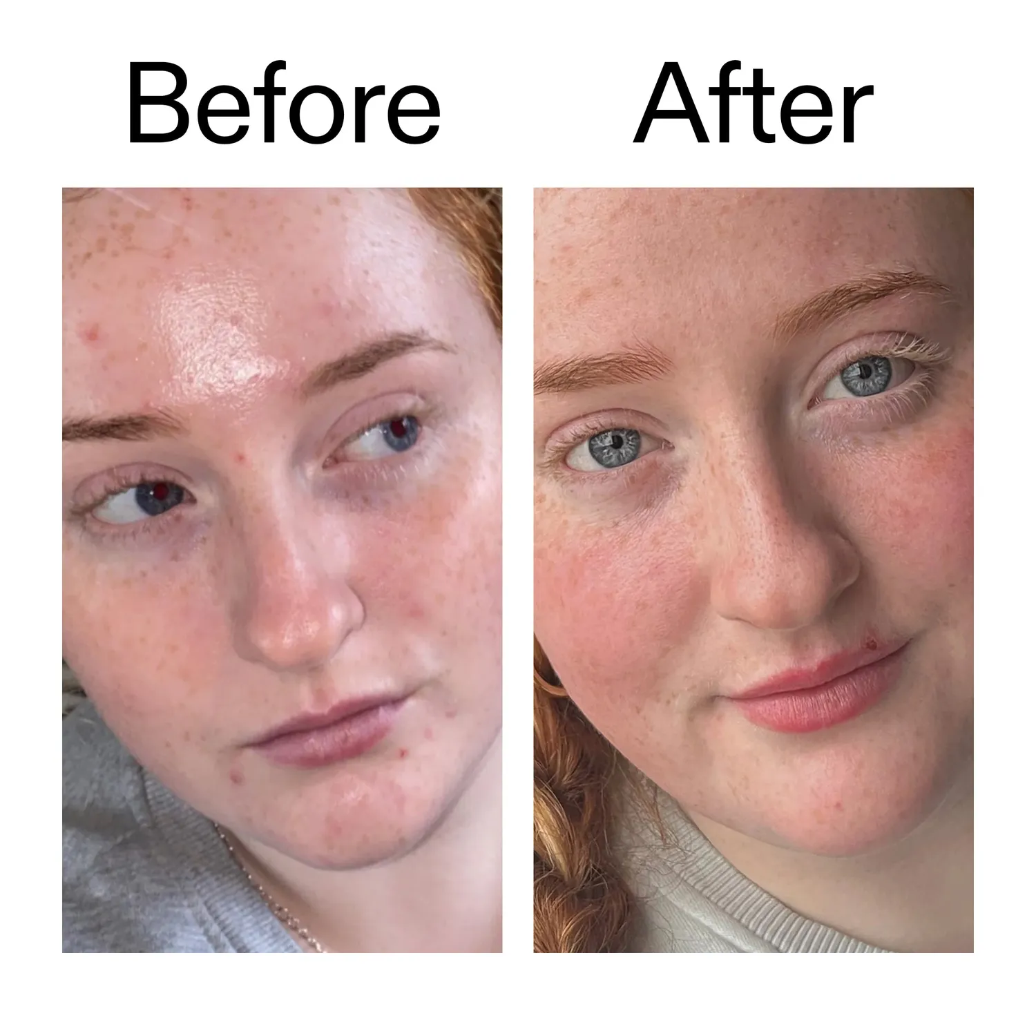 THE INKEY LIST Vitamin B C E crème visage hydratante 50 ml