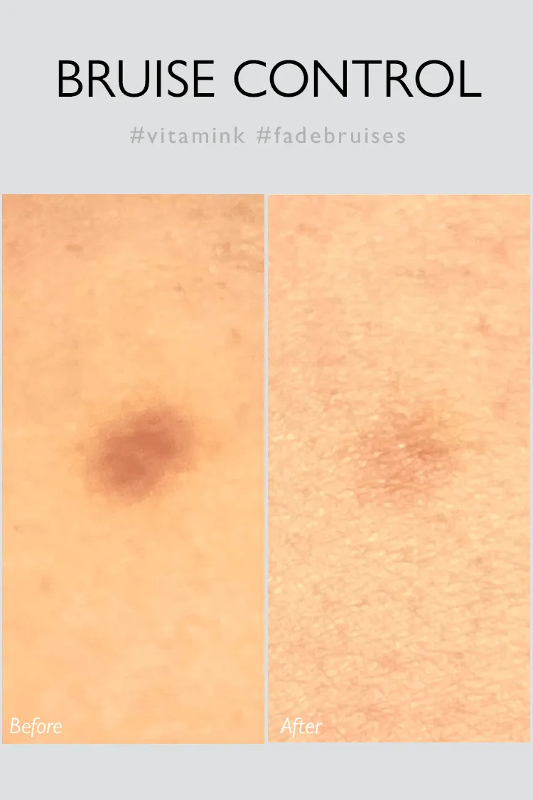 Genabelle Bluecalm Rescue Gel 10ml rougeurs ciblé