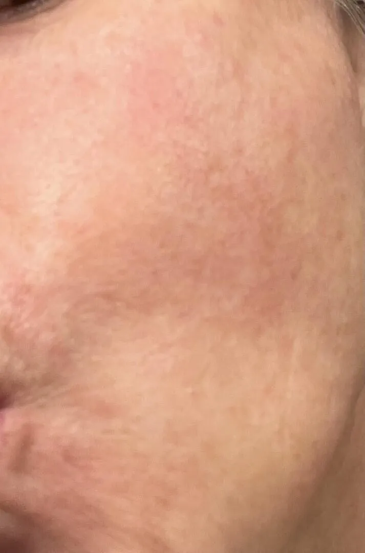 VT Cosmetics TX-Toning Daily Mask masque taches