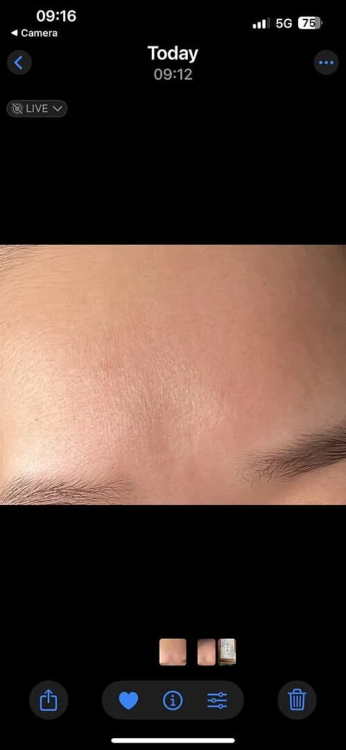 VT Garlic AC Reedle Shot crème gel ail