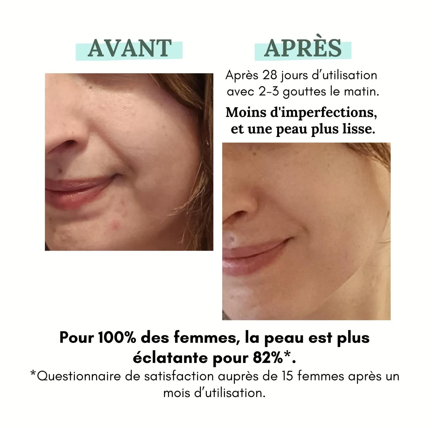 Les Huilettes Day sérum anti-imperfections jour bio