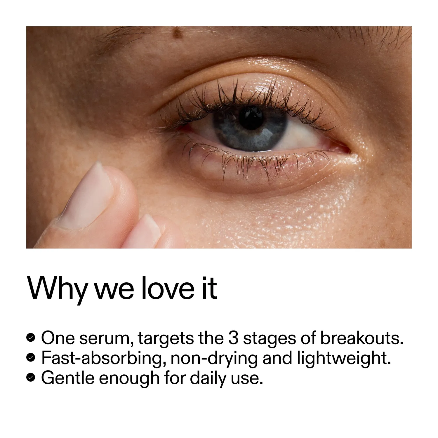 THE INKEY LIST 360 Skin Clearing sérum 30ml imperfections