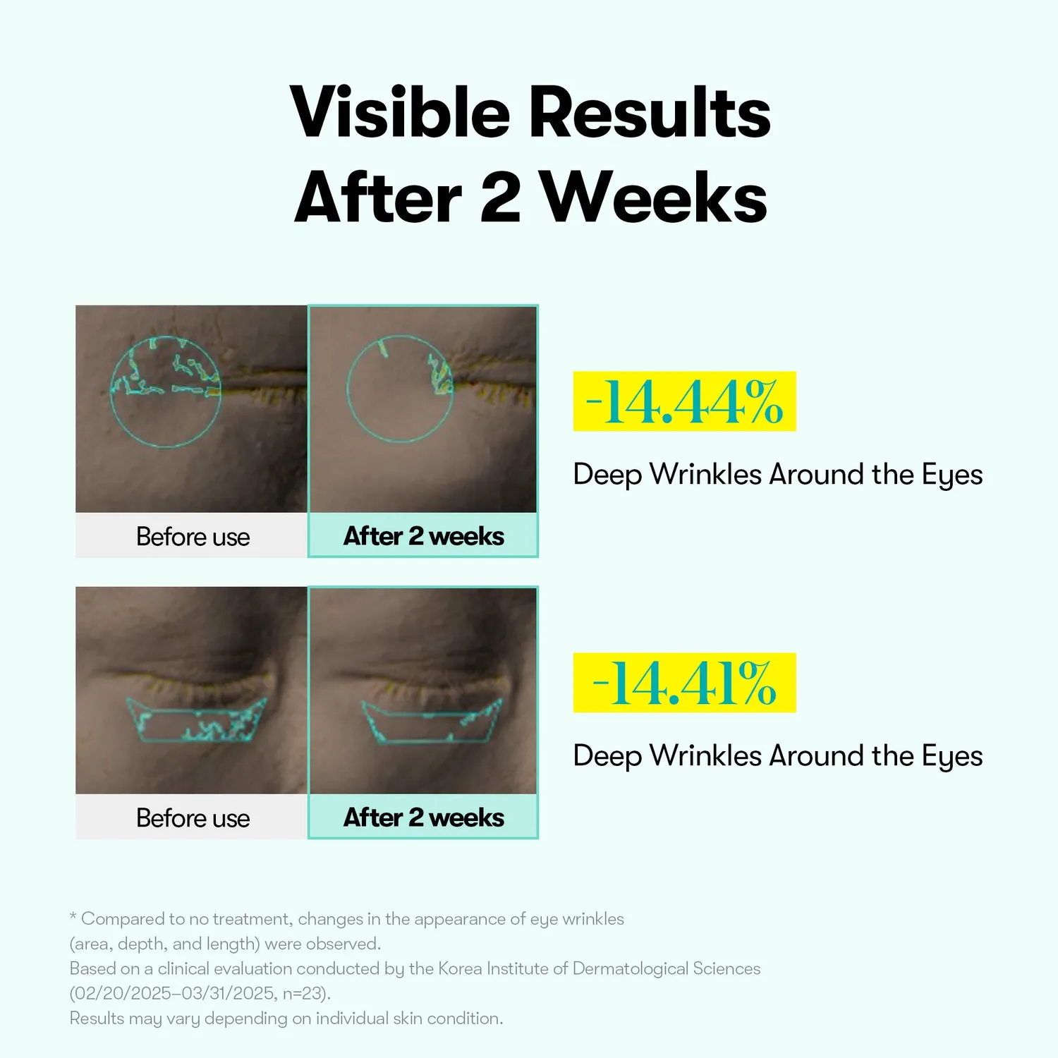 VT PDRN Reedle Shot crème yeux fermeté