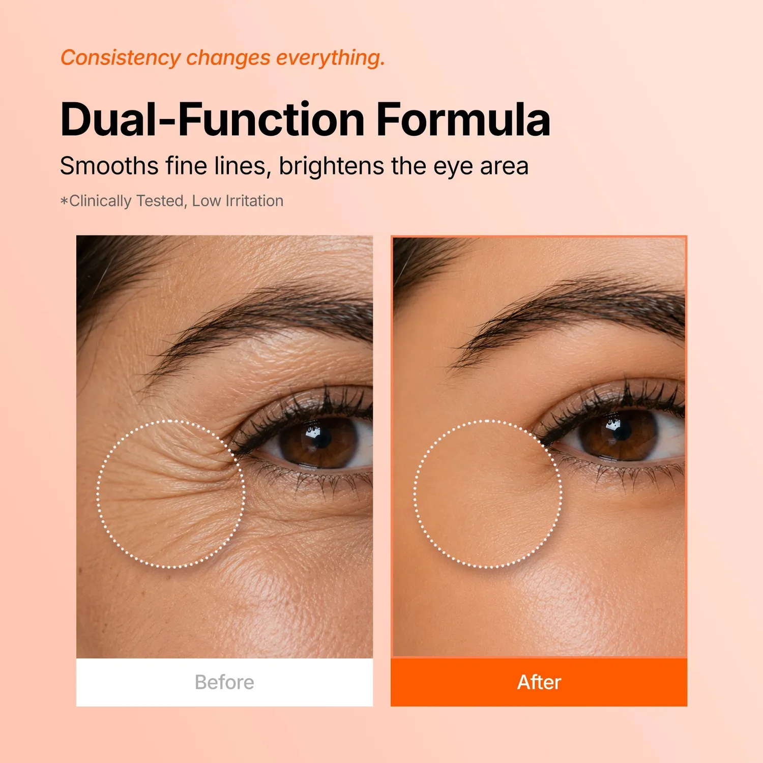 Genabelle PDRN 360° masque yeux régénérant cernes