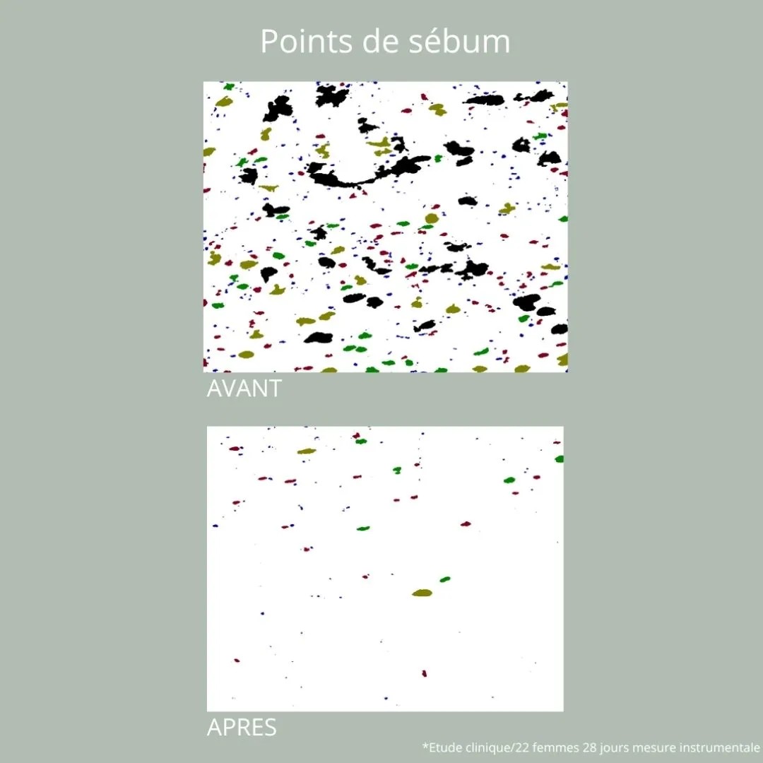 La Bossie Sérum Probiotique Anti-Imperfections sérum imperfections