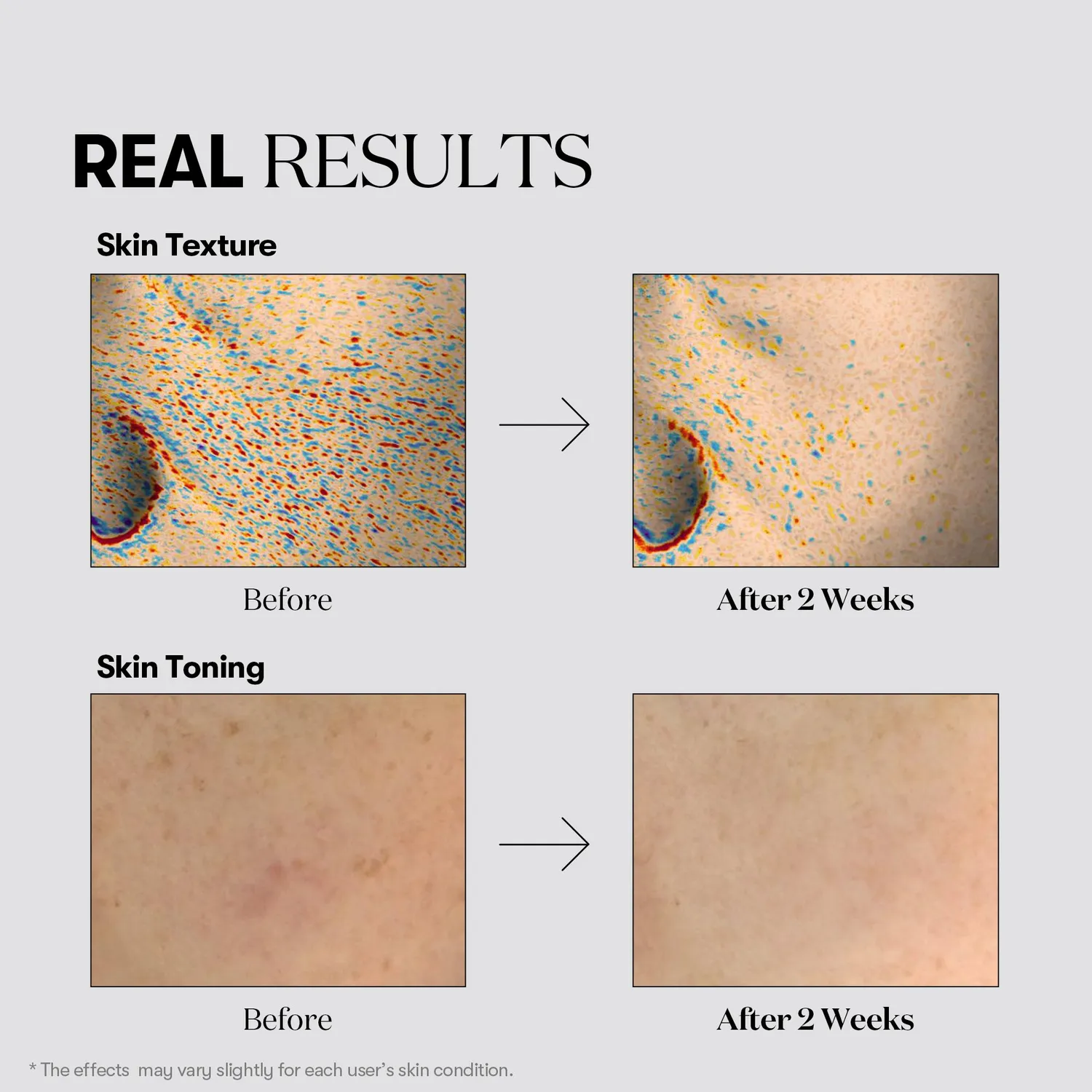 VT TX-Toning Essence 1000 Shot sérum taches