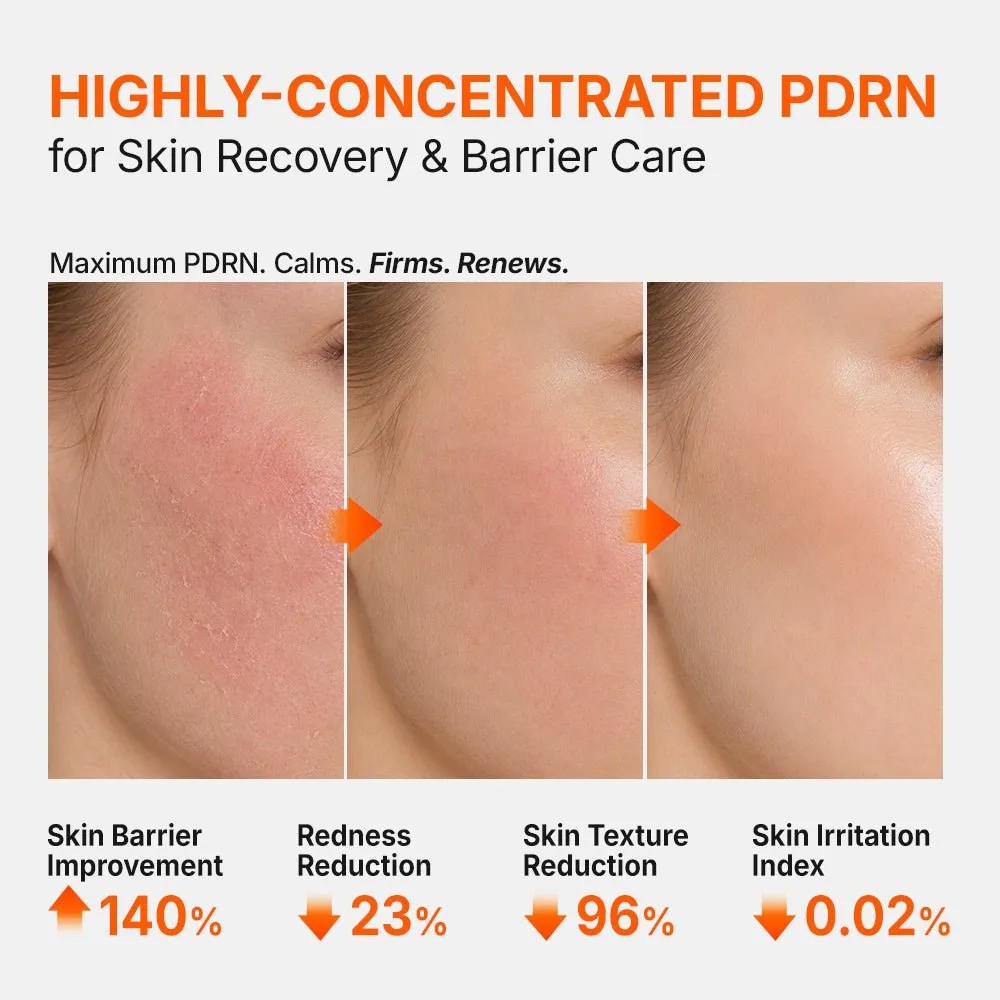 Genabelle PDRN 3% Hyper Boost Ampoule ampoule ferme