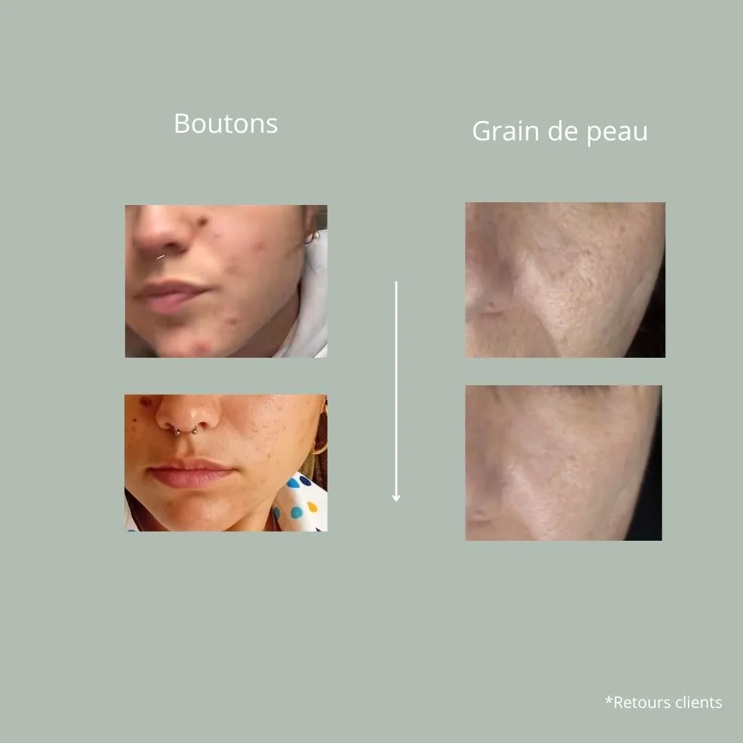 La Bossie Sérum Probiotique Anti-Imperfections sérum imperfections