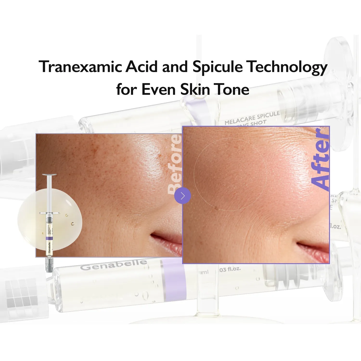 Genabelle Melacare Dark Spot Corrector Kit coffret anti-taches