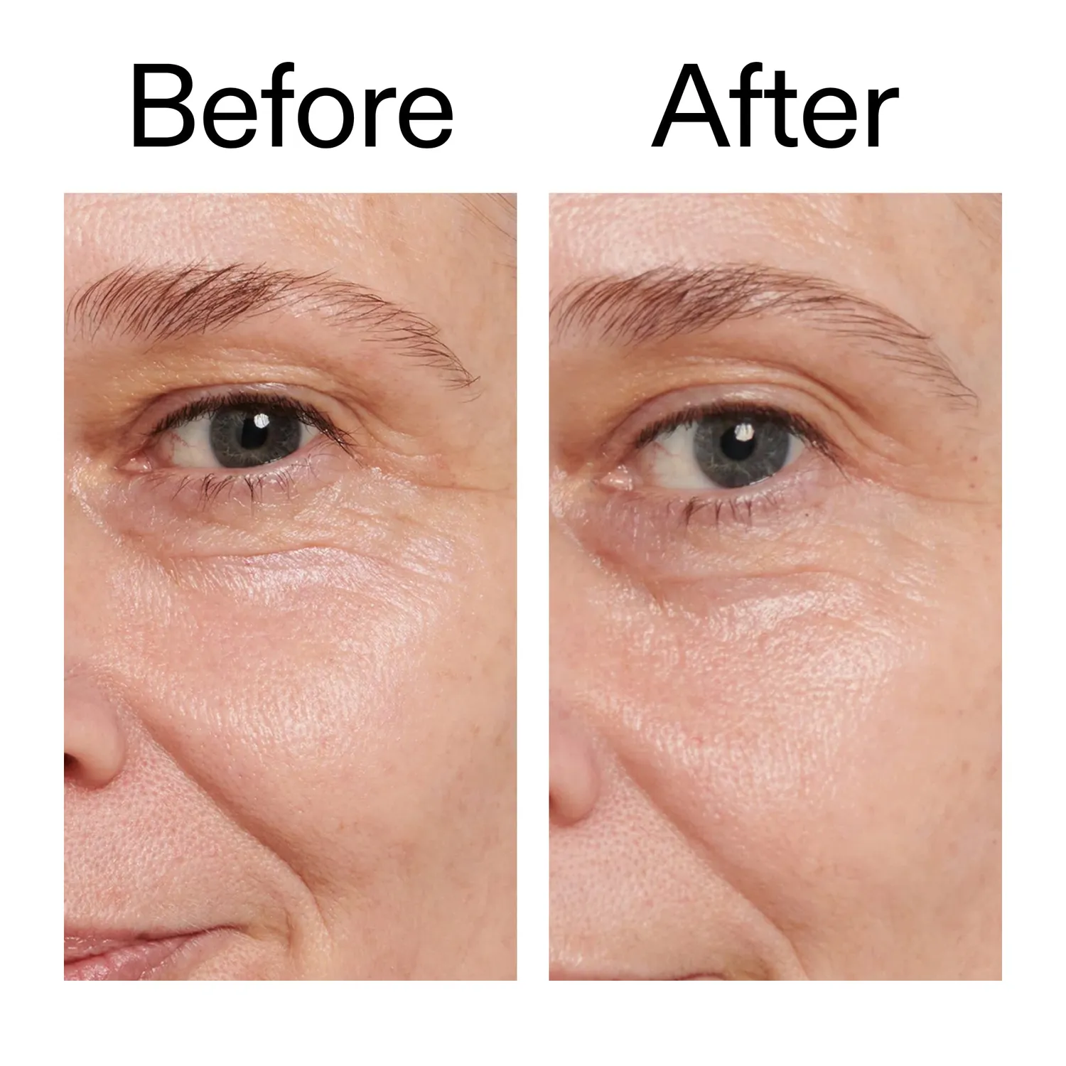 THE INKEY LIST Retinol Eye Cream contour yeux nuit 15ml rides