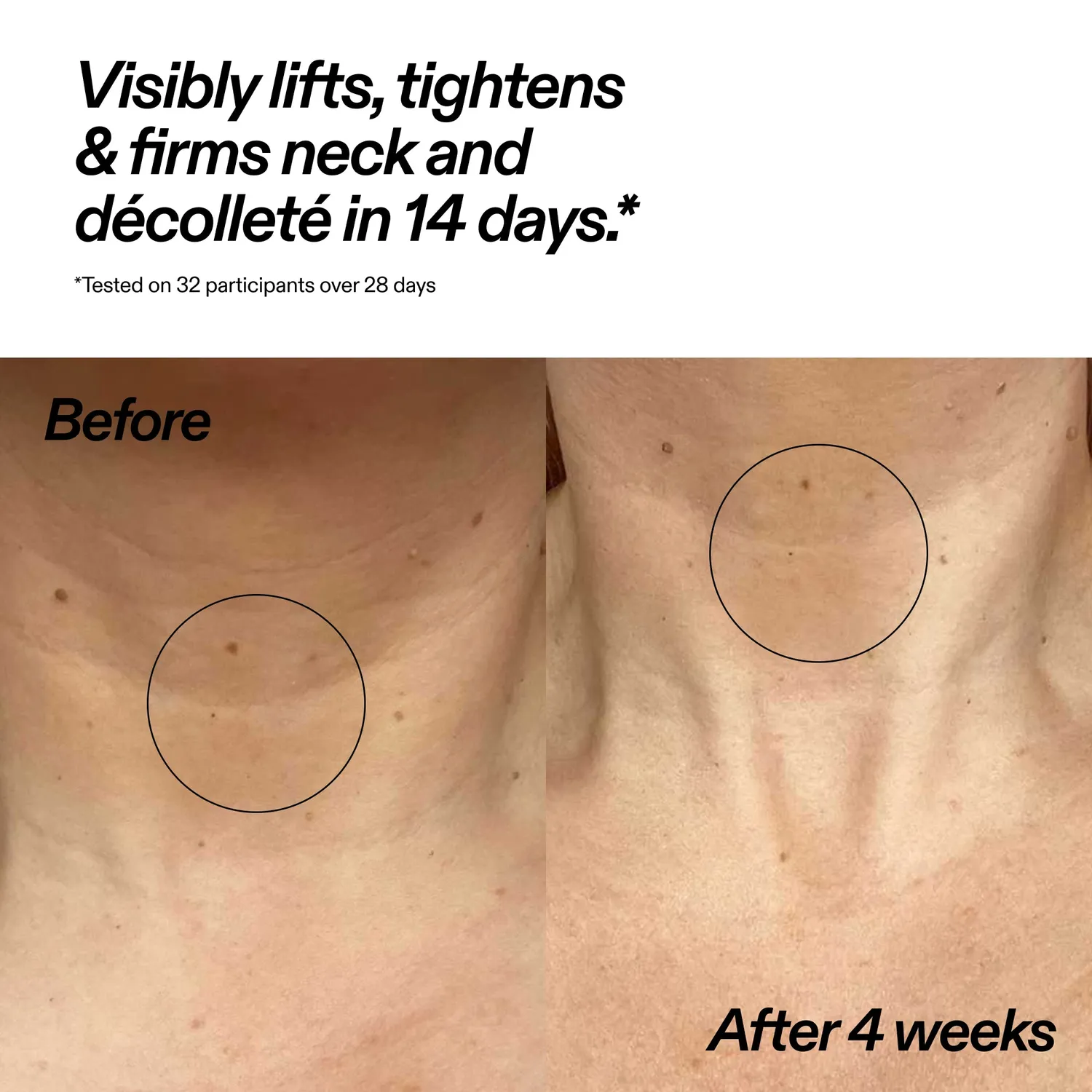 The Inkey List Bio-Active Ceramide Neck Stick soin cou 20g rides