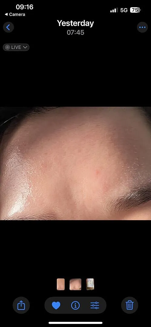 VT Garlic AC Reedle Shot crème gel ail
